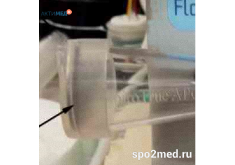 Сетка микрофильтрующая к датчику потока SpiroTrue